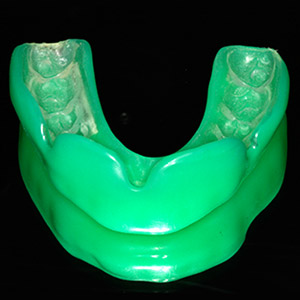 Zahnarztpraxis Dr. Tritten - Zahnschutz